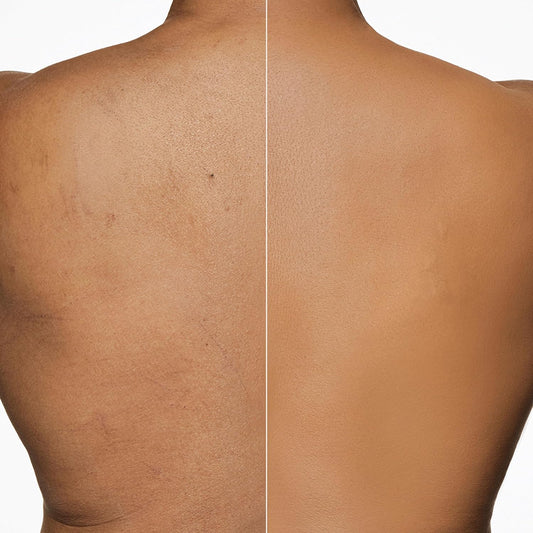 Dermablend Leg and Body Makeup Foundation with SPF 25