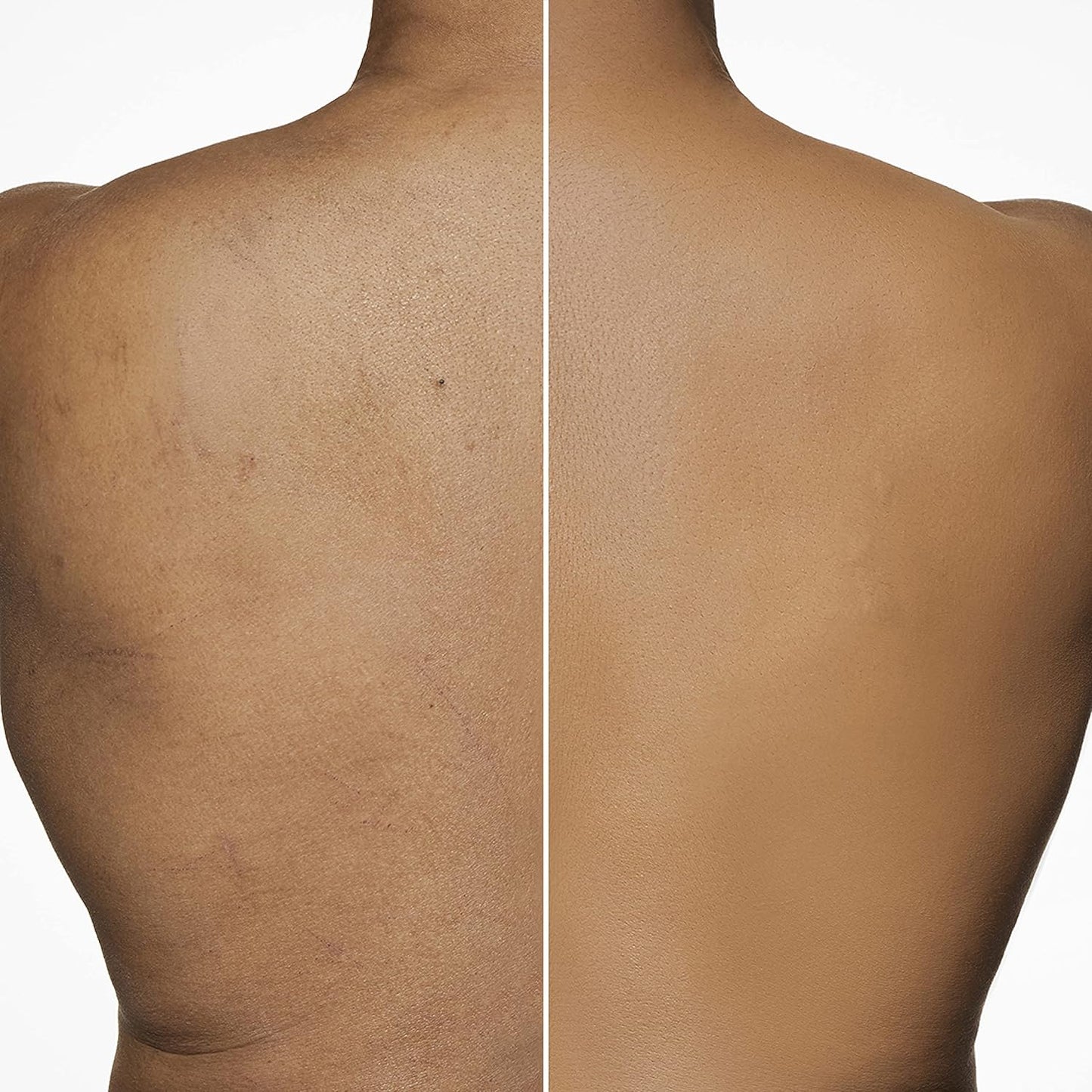Dermablend Leg and Body Makeup Foundation with SPF 25
